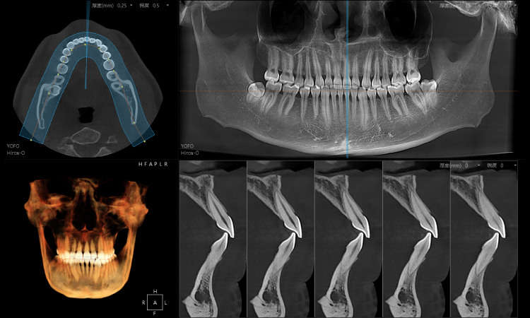 全3D诊疗，提供完善的口腔临床解决方案