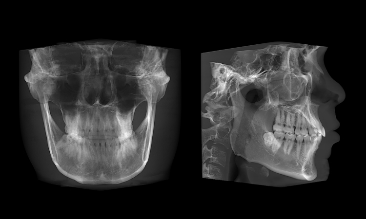 全3D诊疗，提供完善的口腔临床解决方案