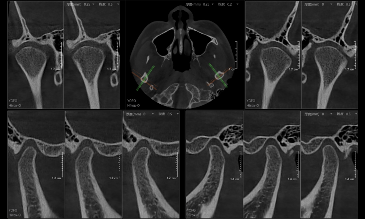 全3D诊疗，提供完善的口腔临床解决方案