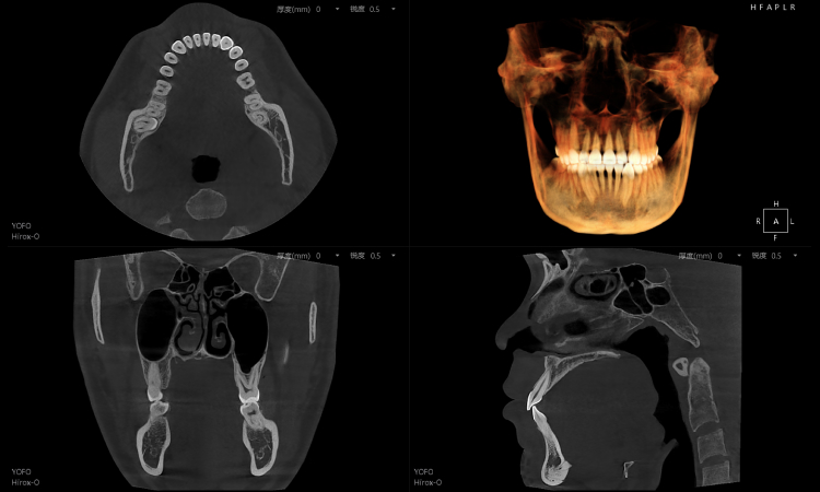 全3D诊疗，提供完善的口腔临床解决方案