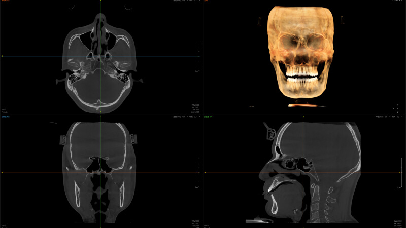 全3D诊疗，提供完善的口腔临床解决方案