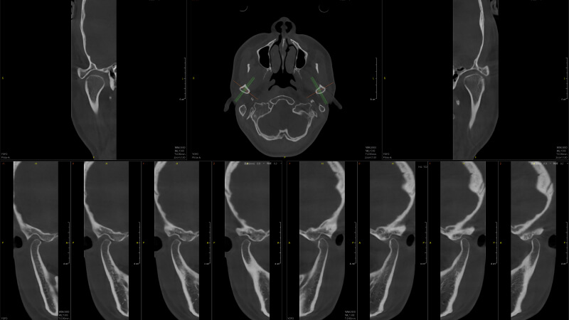 全3D诊疗，提供完善的口腔临床解决方案