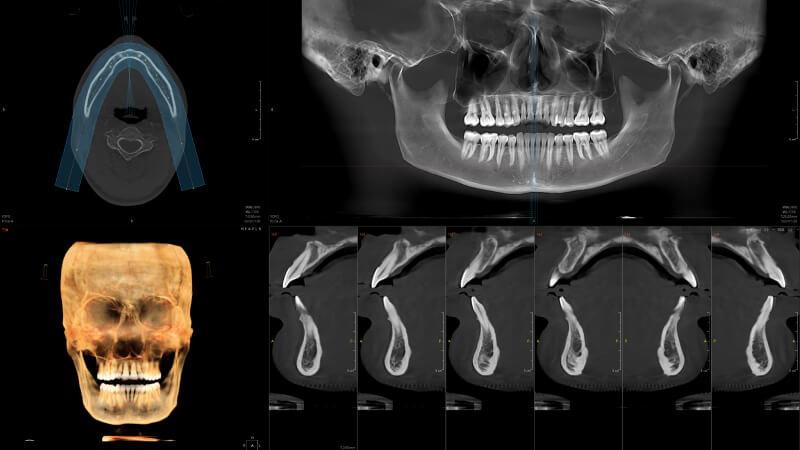 全3D诊疗，提供完善的口腔临床解决方案