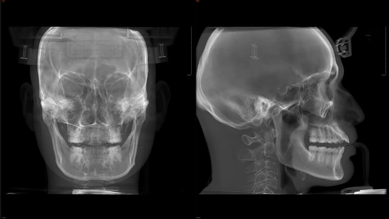 全3D诊疗，提供完善的口腔临床解决方案